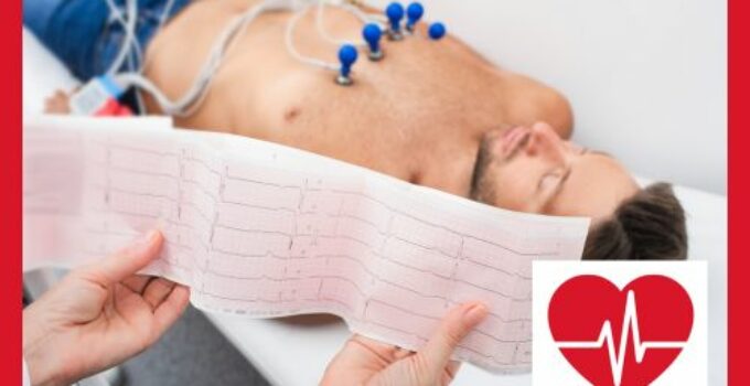 ICD System – Implantierbarer Kardioverter-Defibrillator