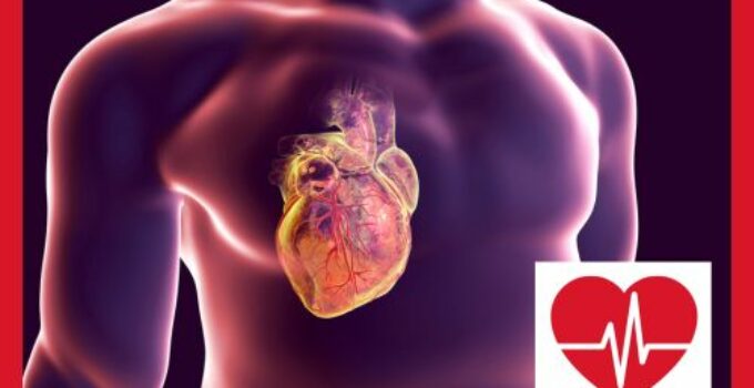 Kardiale Resynchronisationstherapie (CRT)